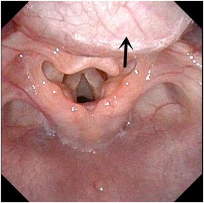 The clinical application of flexible bronchoscopy in a neonatal intensive care unit